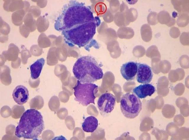 中晚幼粒细胞：血液中的重要成分